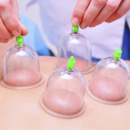 KK15 chinesische Blasen ohne Blasen für Cellulite 12er Pack mit Pumpe