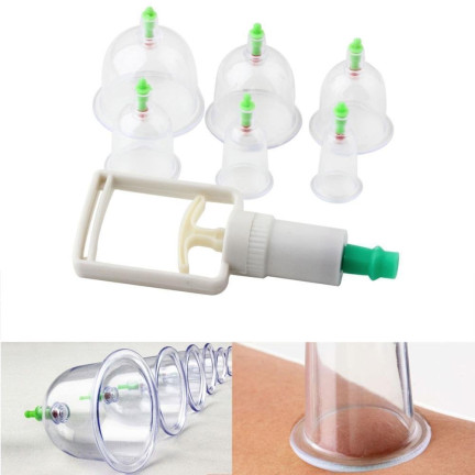 KK15 chinesische Blasen ohne Blasen für Cellulite 12er Pack mit Pumpe