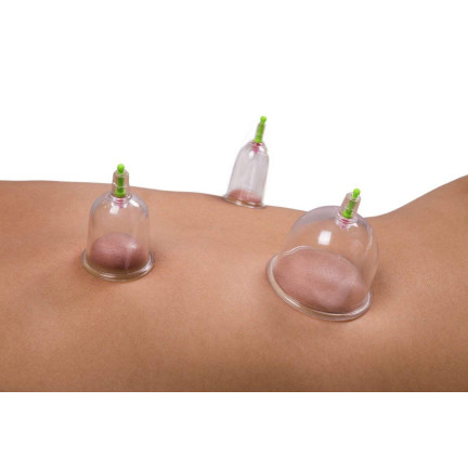KK15 chinesische Blasen ohne Blasen für Cellulite 12er Pack mit Pumpe